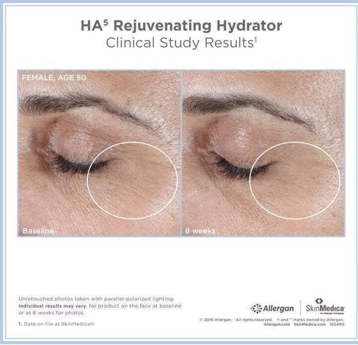 SkinMedica HA5 Rejuvenating Hydrator 2 oz – New Sealed